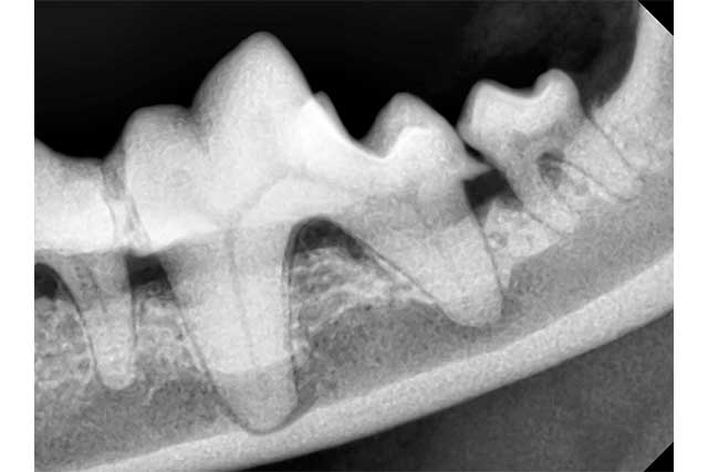 歯科用レントゲン装置による細かな診断
