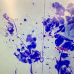 皮膚の細胞診画像