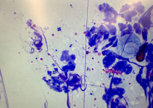 皮膚にできたしこりの細胞診