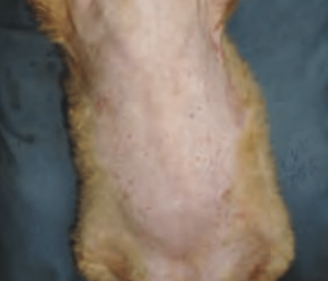 外傷性脱毛（がいしょうせいだつもう）