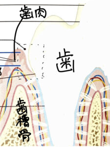 通常の歯と歯肉と歯槽骨のイラスト