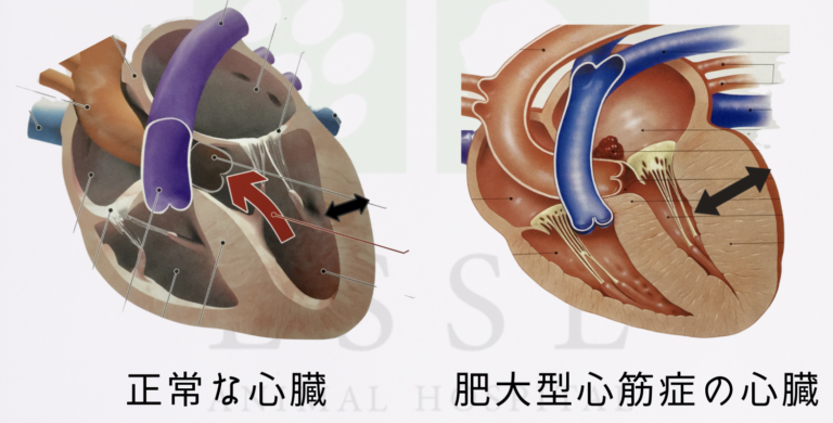 猫の心臓病 ｜ 肥大型心筋症とは？後ろ足にも症状が出る！？症状・治療などを紹介。 ｜ 長生きのための知識｜吹田市（北千里駅）・箕面市・豊中市の ...