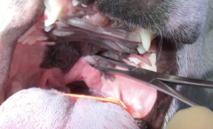 余分な軟口蓋を引っ張っている図