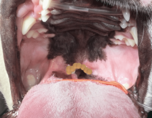 過剰な軟口蓋を切除した後