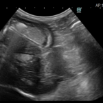 胃内異物が疑われる犬のエコー画像