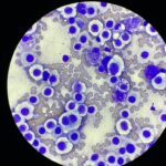 肥満細胞腫の細胞診