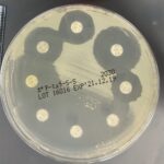 薬剤感受性試験の様子