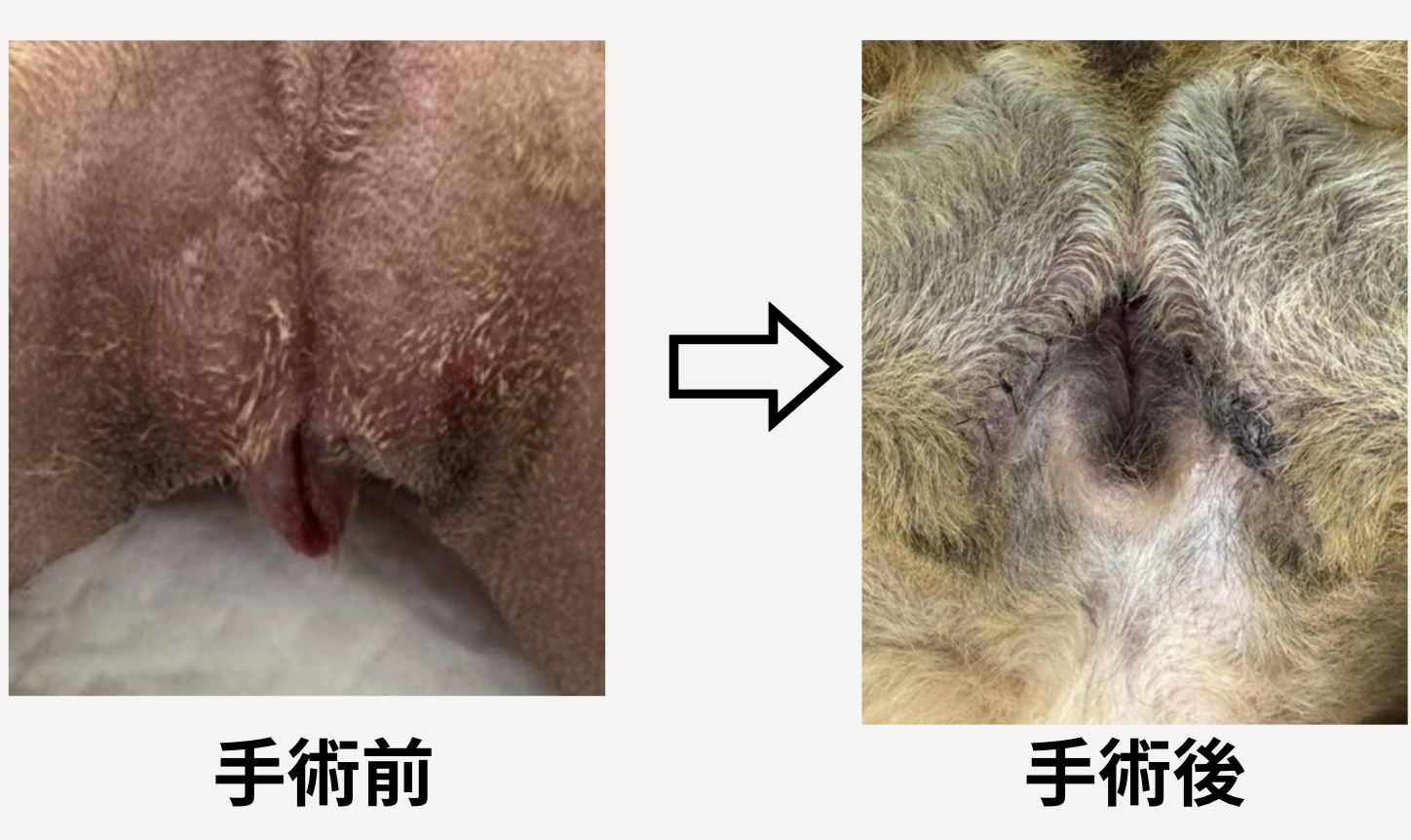外陰部形成の写真
