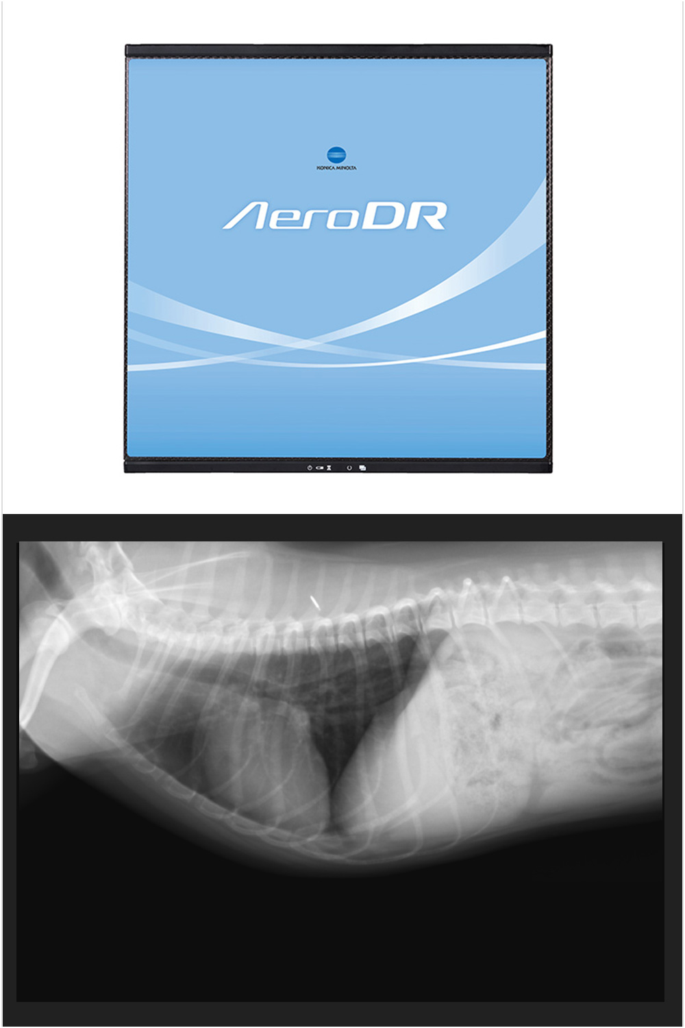 Aero DR(デジタル レントゲン装置)