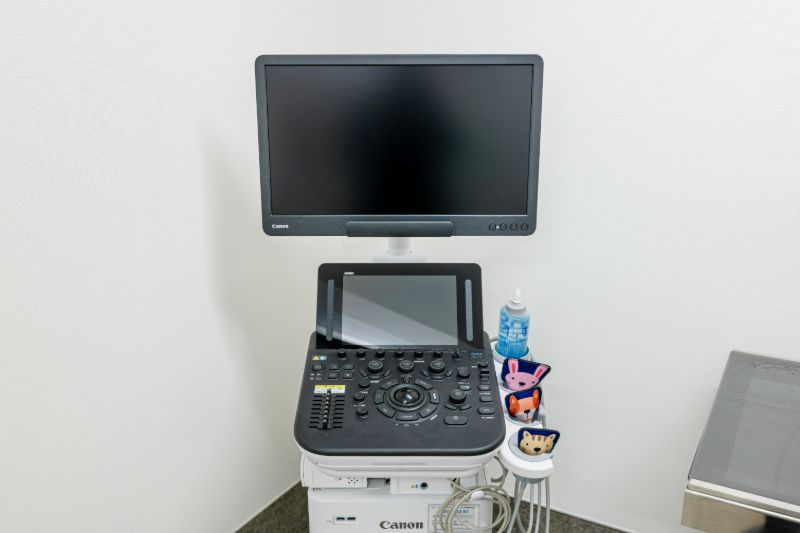 超音波診断装置