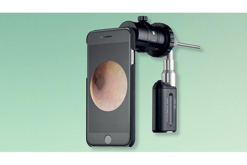 SMART SCOPE（耳のカメラ）