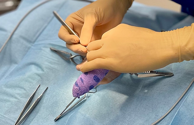 最新の「電気化学療法」と豊富な手術実績