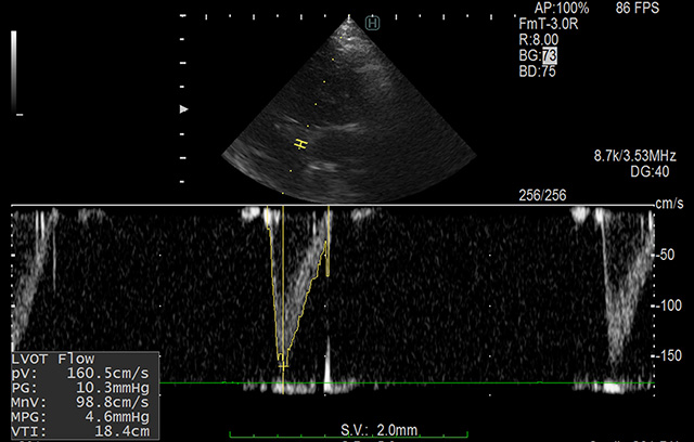 高性能エコーによる「精密な可視化」