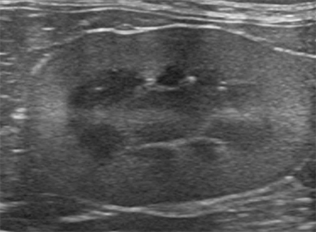 高性能エコーによる「徹底した原因追及」
