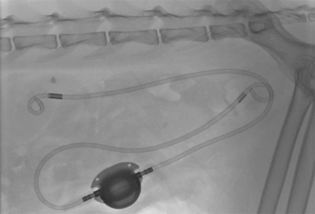 SUBシステム・マイクロサージェリーへの対応