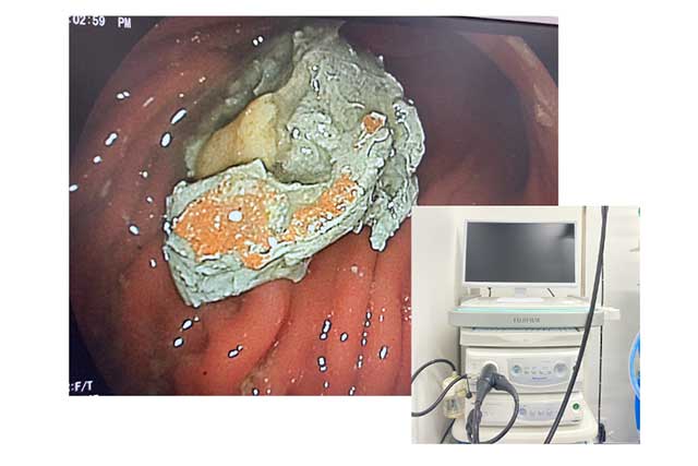 高性能エコー・レントゲンによる「瞬時の見極め」