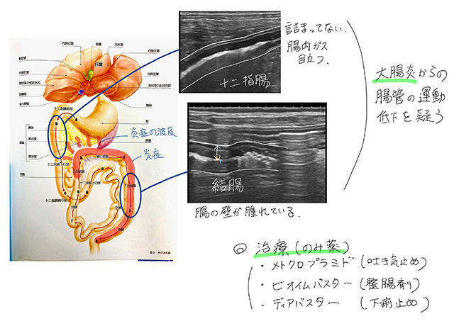 診断と治療方針のご相談