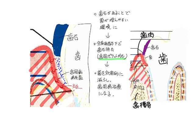 歯科処置（全身麻酔下）