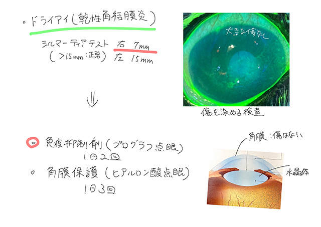 診断と治療プランのご相談