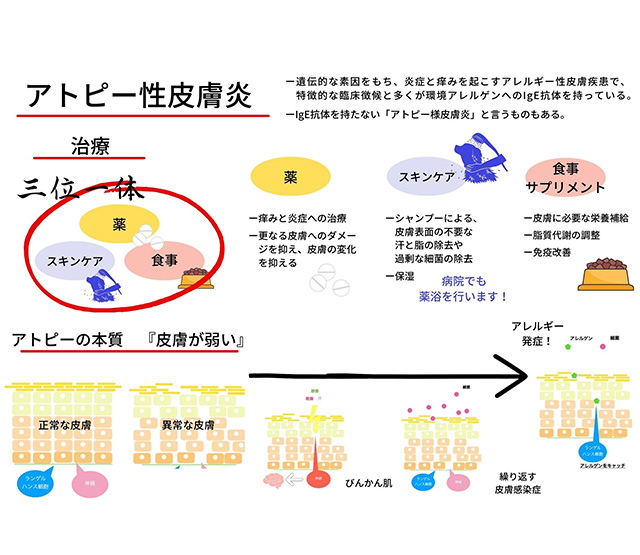 アトピー性皮膚炎で長期間治療中の症例